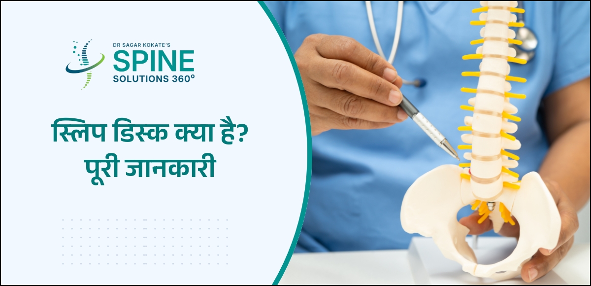 स्लिप डिस्क क्या है पूरी जानकारी
