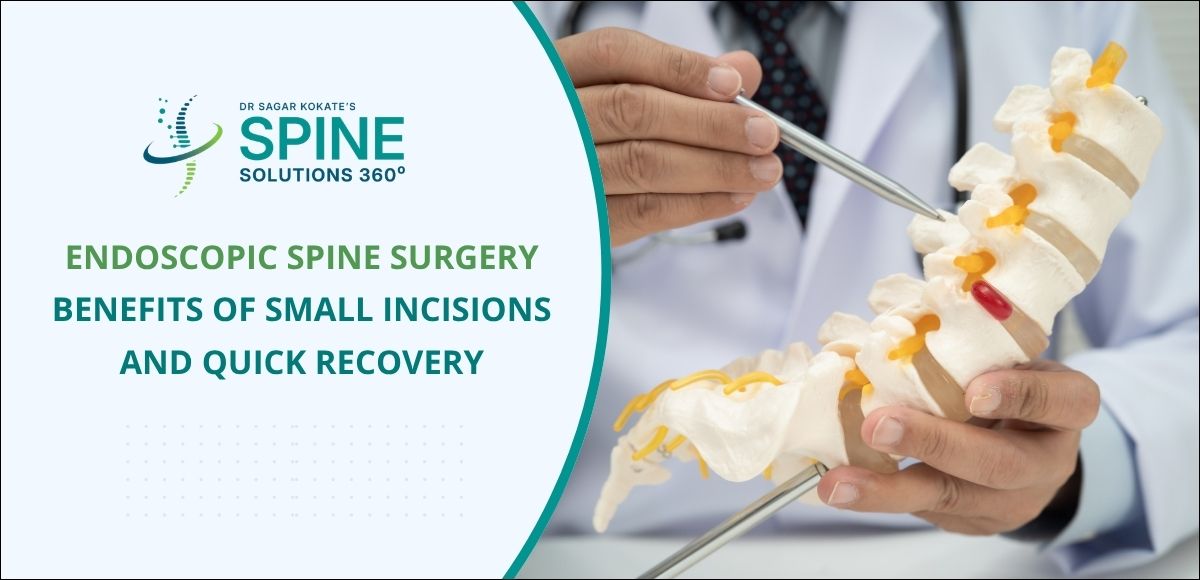 Endoscopic Spine Surgery: Benefits of Small Incisions and Quick Recovery