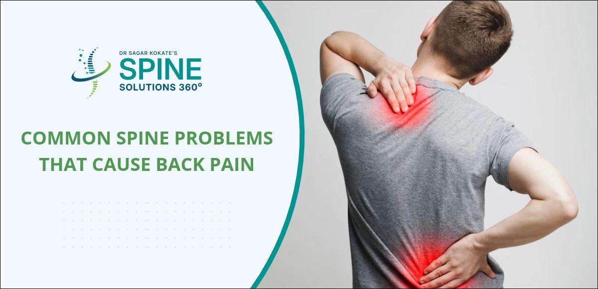 Common spine issues